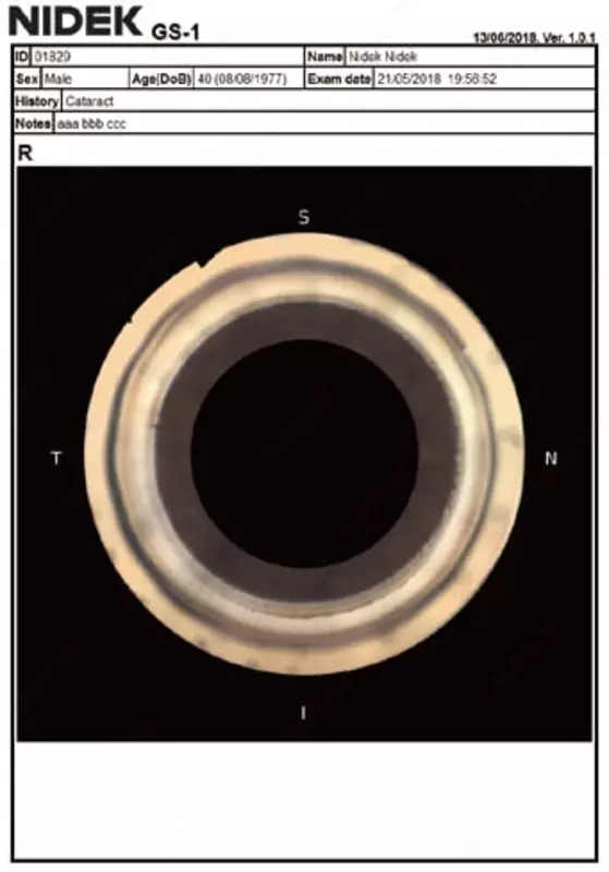 NIDEK GS-1 Автоматизированный гониоскоп Оптом и розница