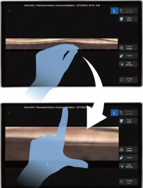 NIDEK GS-1 Автоматизированный гониоскоп NIDEK Uzbekistan