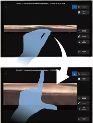 NIDEK GS-1 Автоматизированный гониоскоп NIDEK Uzbekistan
