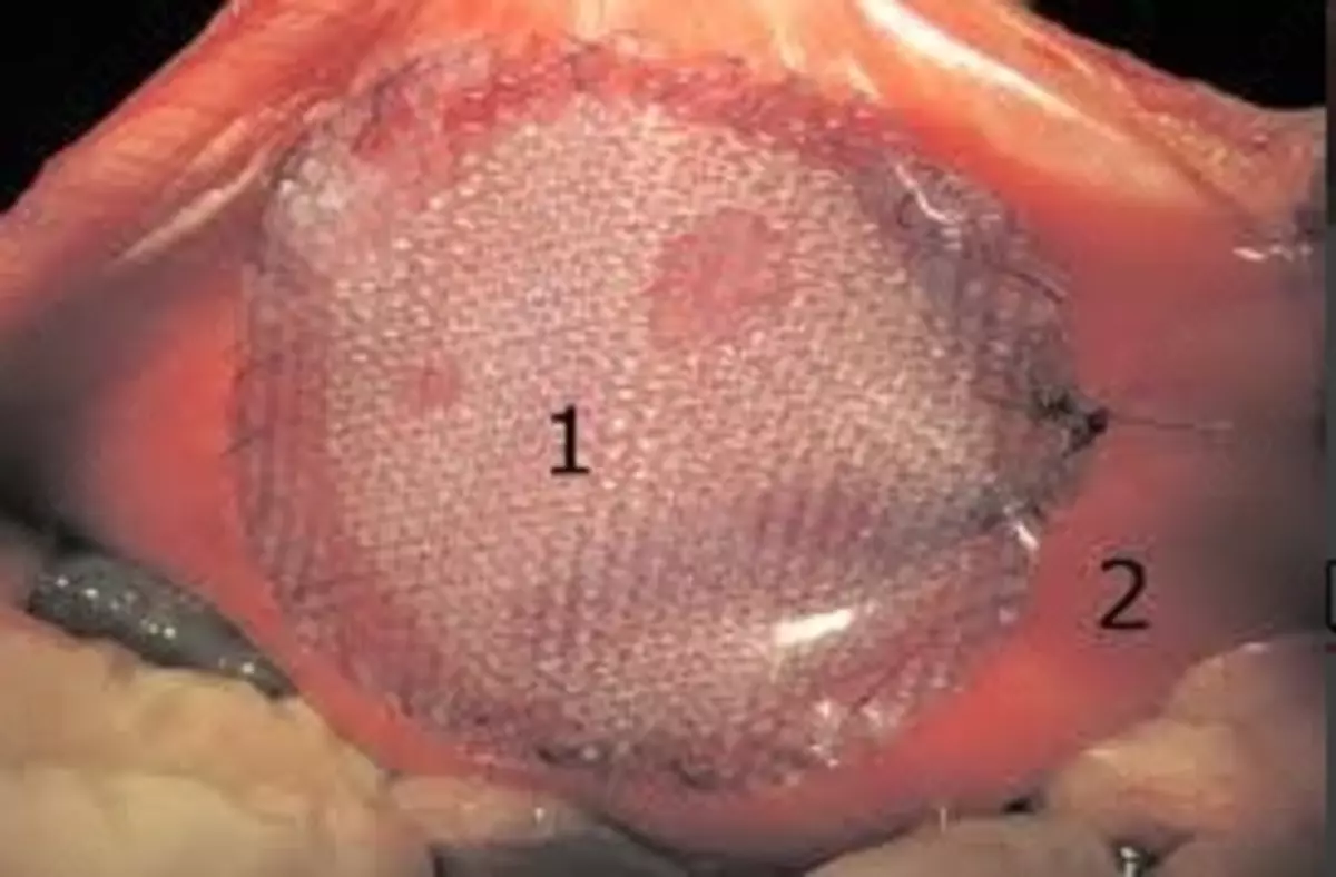 2025-08-29-10-22-23-356154-71f3322221618c47c0ff500ccb1bc72f.webp?_=ozbol