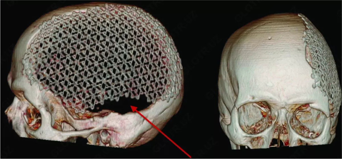 2025-08-29-11-05-31-804543-6a9f6a452387a81353a18b4741d69587.webp?_=ozbol