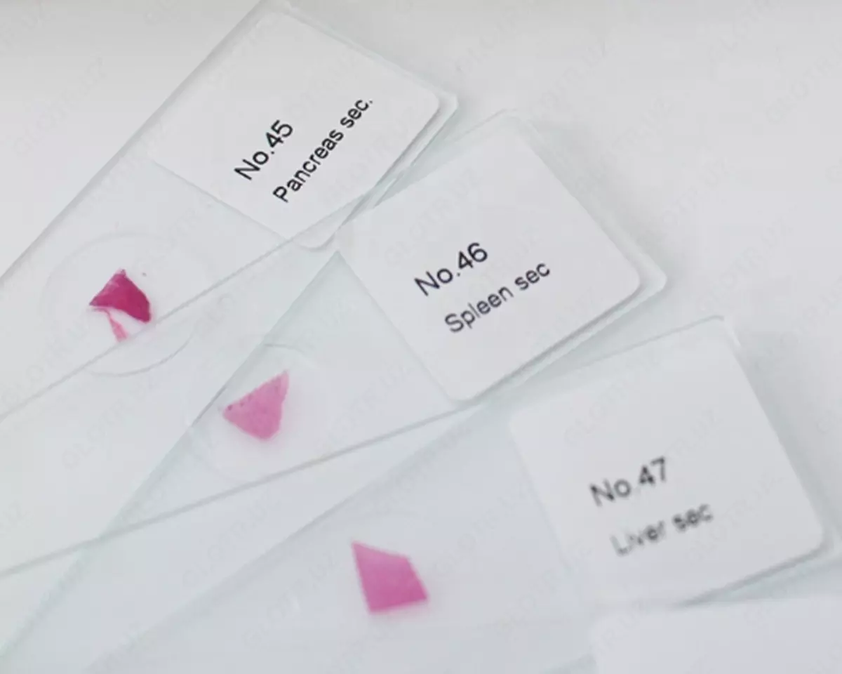 2025-12-01-12-58-09-751835-9109d7984f25ec9b51bd879074f90442.webp?_=ozbol